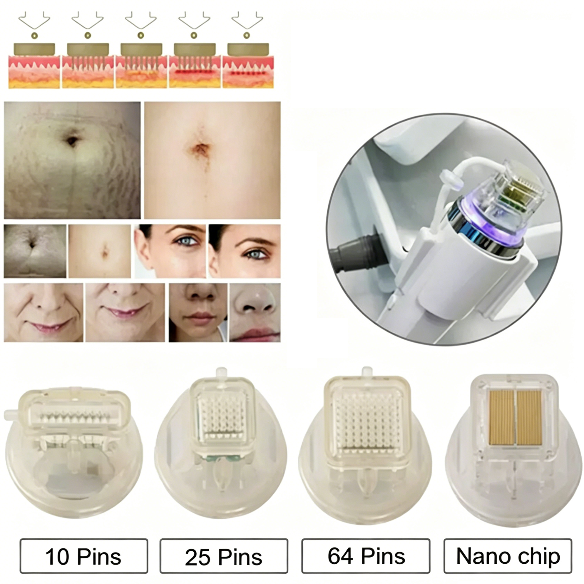 Fractional RF Beauty Machine Cartridges Replacements Working Heads, 5/10/20 PCS Gold Plated with One Side Slot (25Pin / 64Pin)