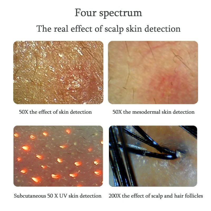 2 In 1 Skin Hair Scalp Analyzer Detector Machine 11 Inch LCD Screen Skin Hair Condition Tester for Beauty Salon Home Use