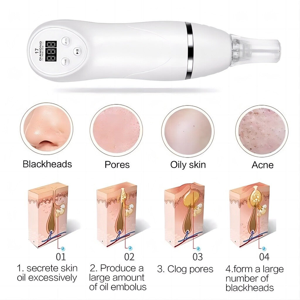 Diamond Microdermabrasion Blackhead Removal Vacuum Peeling Skin Rejuvenation Dermabrasion Facial Massage Beauty Device