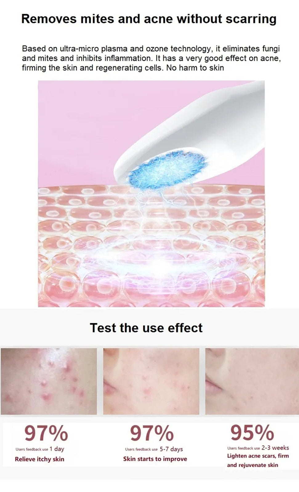 Eye Lifting Ozone Plasma Pen Acne Treatment Beauty Facial Device Ozone Plasma Jet Pen