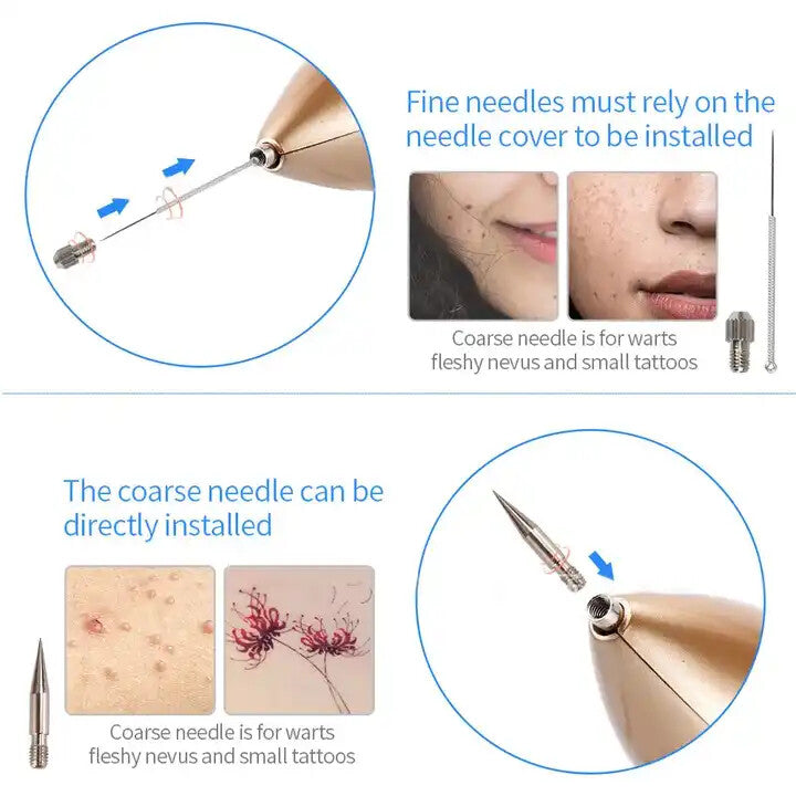 9-level Blue Light Mole Warts Removal Pen - Portable Beauty Instrument USB Charging Beauty Device
