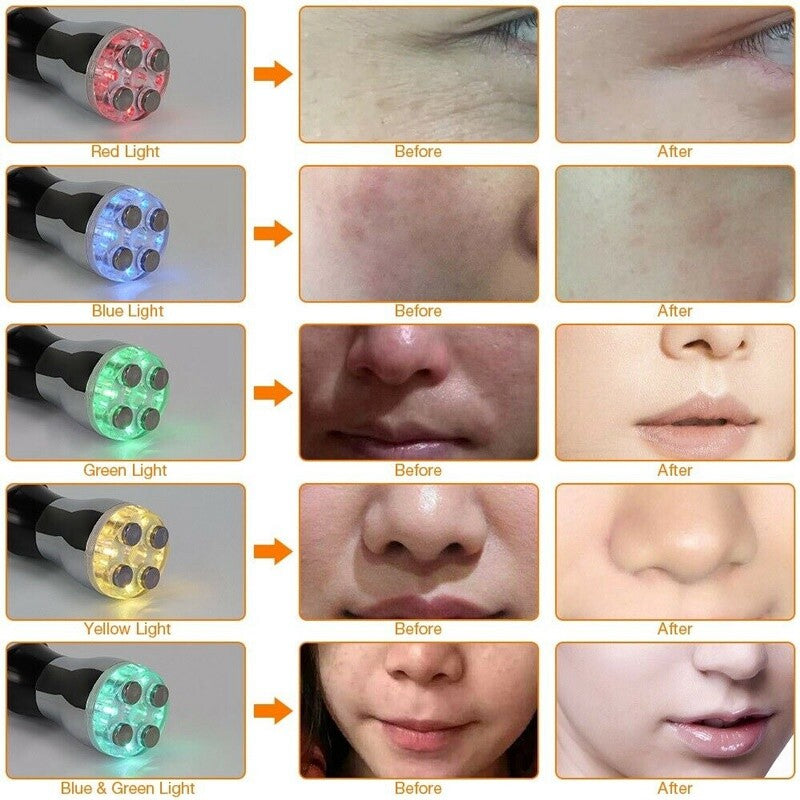 Mini RF Radio Frequency Facial Beauty Machine Home Use Skin Tightening Lifting Anti Wrinkle Face Rejuvenation Salon Skin Care Device