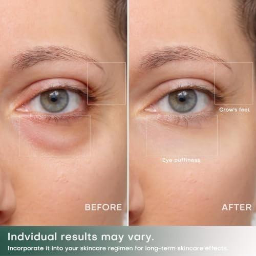 Eye Lifting Machine Face Lift Beauty Instrument Galvanic Micro Current Eye Bag Wrinkle Removal Device for Home Use Beauty Device