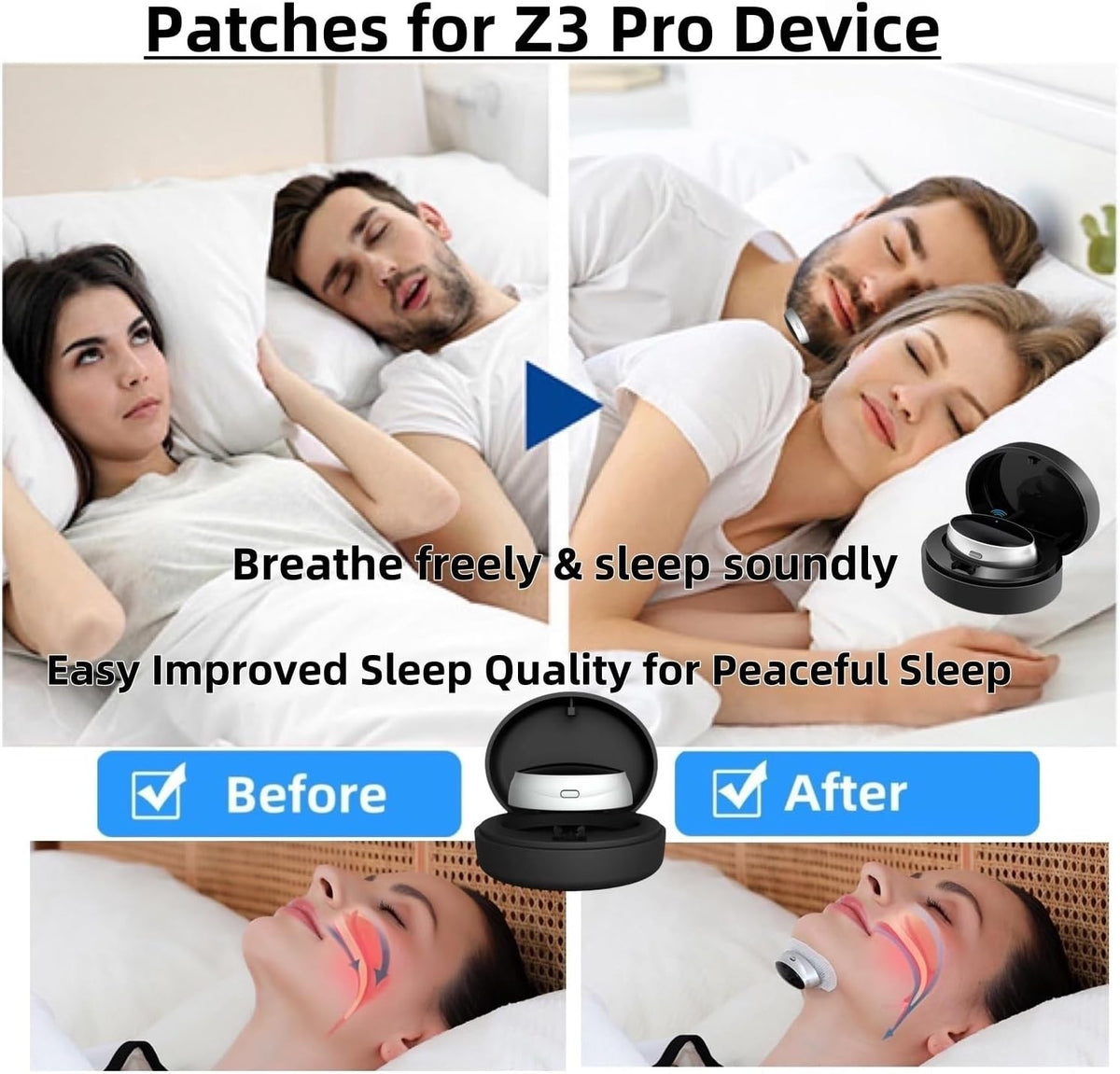 5/10/20 Bags Replacement Non-Woven Anti-Snoring Electrode Pad Patch Accessory for Electric Anti Snore Stopper Machine