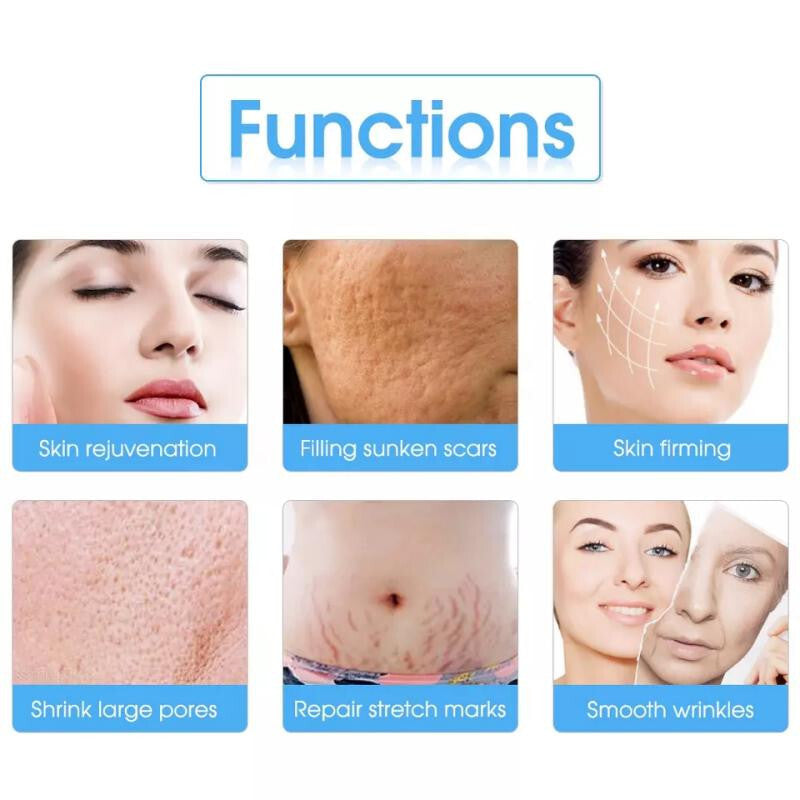 2 Handles Tixel Thermal Fractional Machine, Salon Skin Resurfacing Device for Stretch Mark, Scar & Wrinkle Removal Treatment