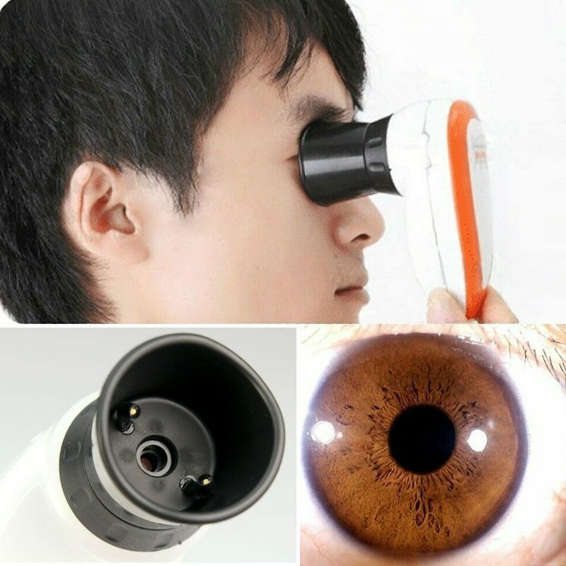 HD 5MP Computer Type USB Iris Detector Analyzer Magnifier Iridology Device Retinal Camera with Aluminum Alloy Box
