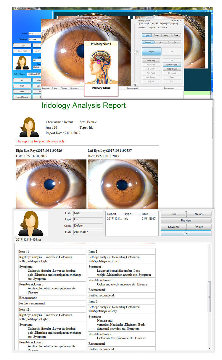 Portable Handheld Iris Scanner 12MP Digital Iriscope Analyzer Iridology Appliance Eye Camera Iris Scanner