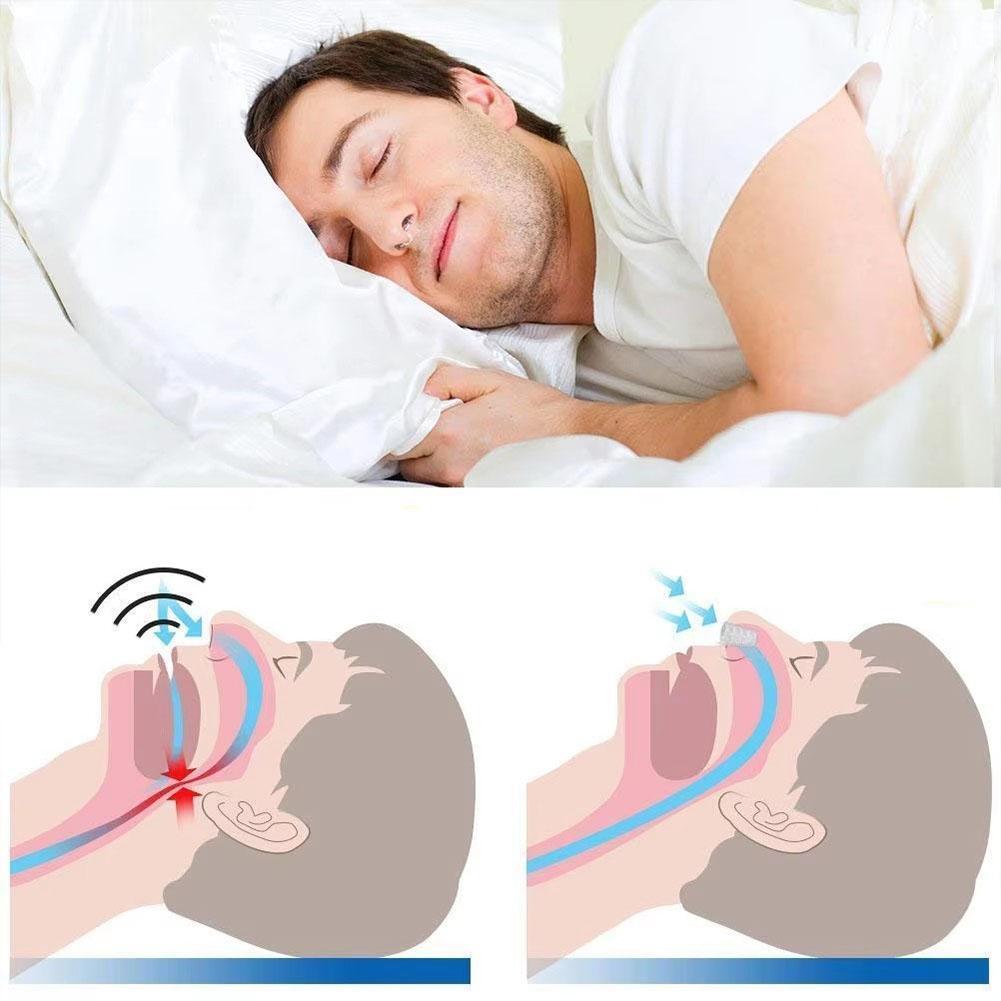 Adjustable Anti Snoring Device Mouth Guard Anti-Snoring Sleep Aid Device Sleeping Bruxism Snoring Stopper Help Sleep Mouthpiece