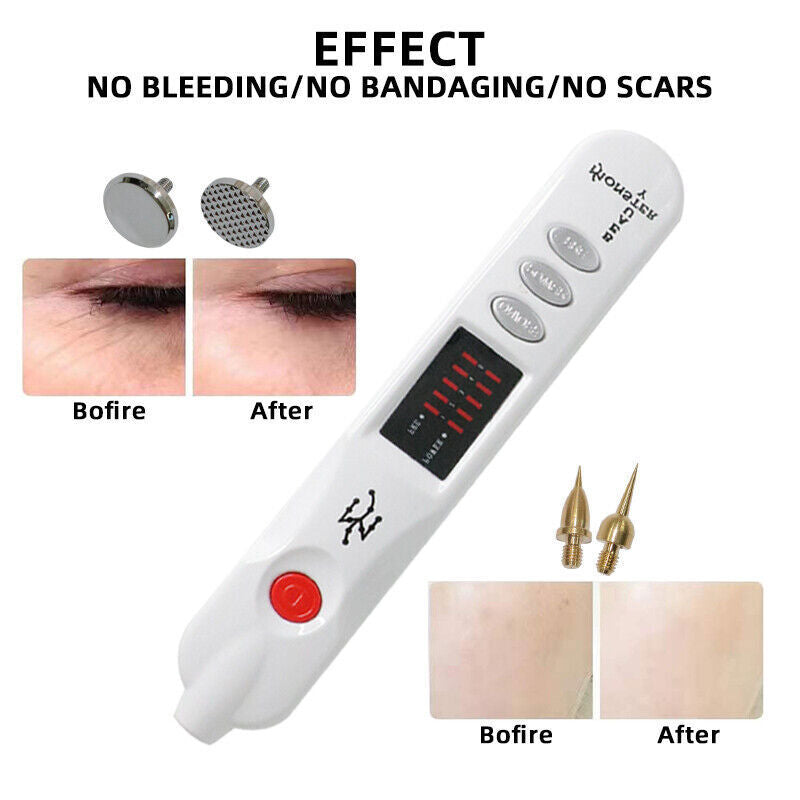 Professional Eyelid Lifting Beauty Monster Plasma Pen Handheld Beauty Pen LED Indicator for Skin Rejuvenation