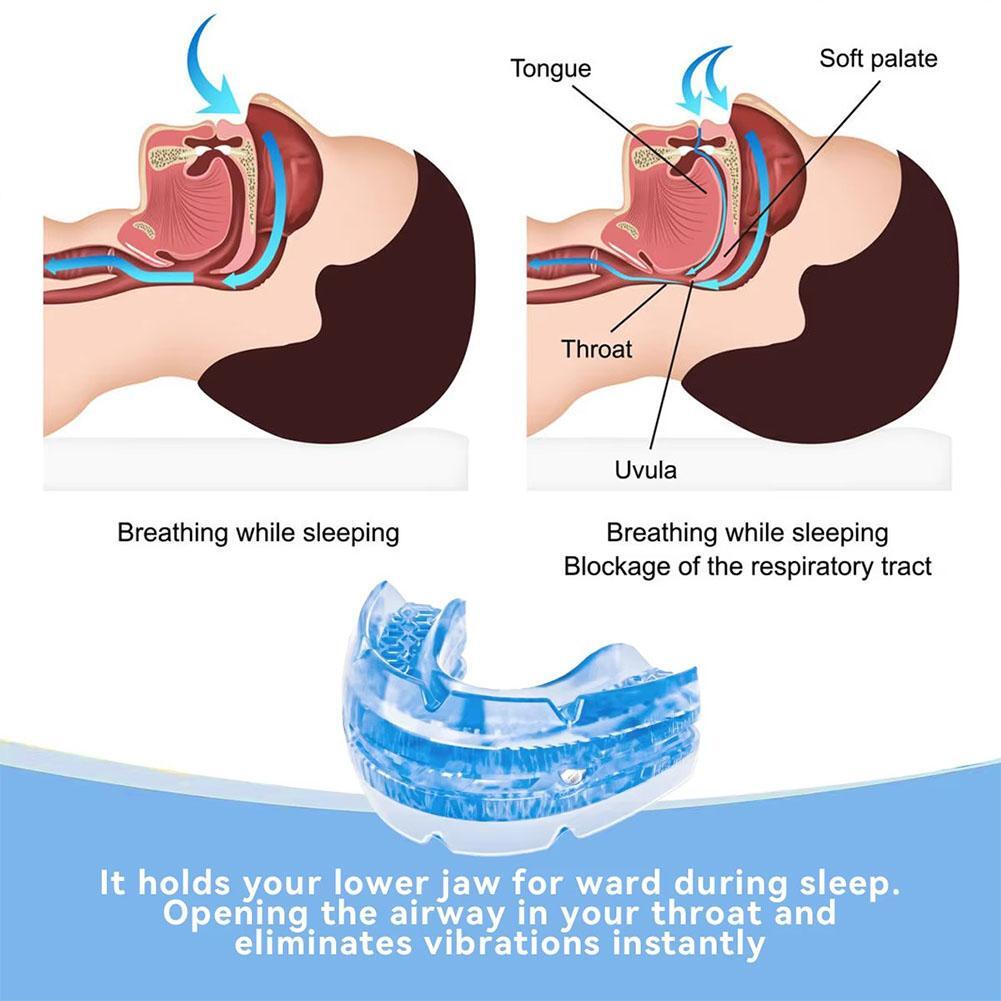 Adjustable Anti Snoring Device Mouth Guard Anti-Snoring Sleep Aid Device Sleeping Bruxism Snoring Stopper Help Sleep Mouthpiece