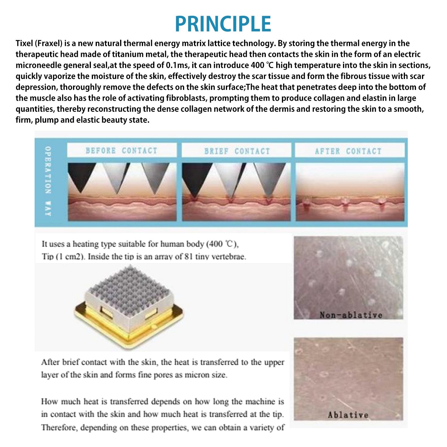 2 Handles Tixel Thermal Fractional Machine, Salon Skin Resurfacing Device for Stretch Mark, Scar & Wrinkle Removal Treatment