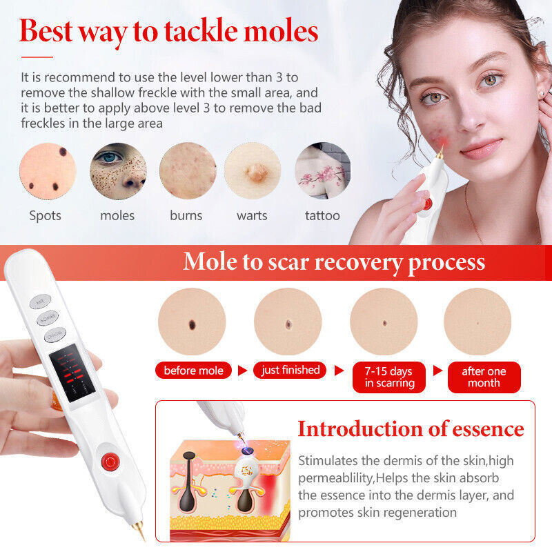 Professional Eyelid Lifting Beauty Monster Plasma Pen Handheld Beauty Pen LED Indicator for Skin Rejuvenation