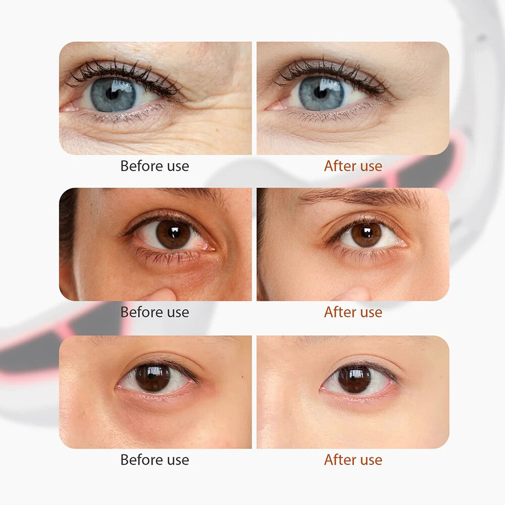 Rechargeable Red Light Therapy Eye Glasses Portable LED Infrared Light Mask For Eye Fatigue Relief Dark Circle Skin Recovery Care Device