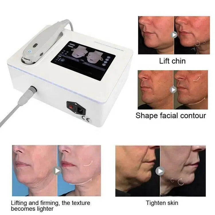 Portable Face & Body Lifting Skin Rejuvenation Machine Wrinkle Remove Skin Tightening Machine