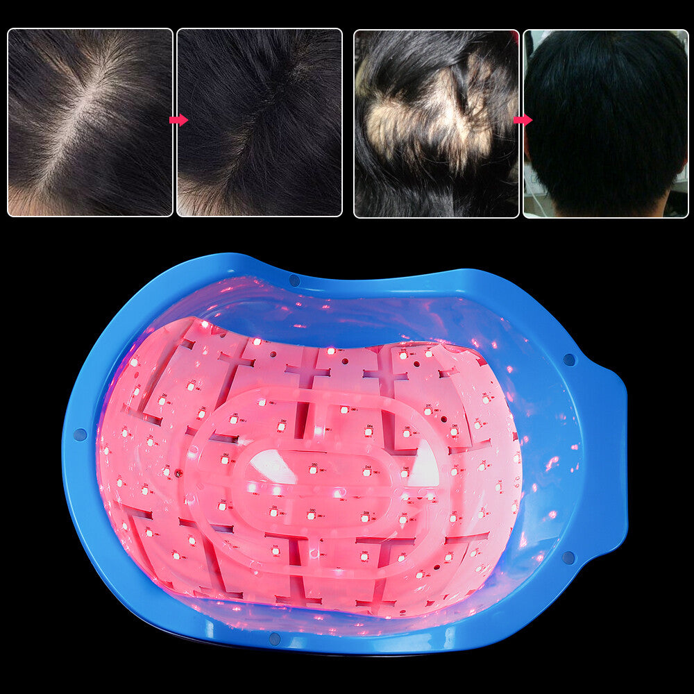 LED Red Light Hair Growth Helmet, Portable Scalp Phototherapy Cap for Thinning Hair, Home Hair Loss Regrowth Treatment Device