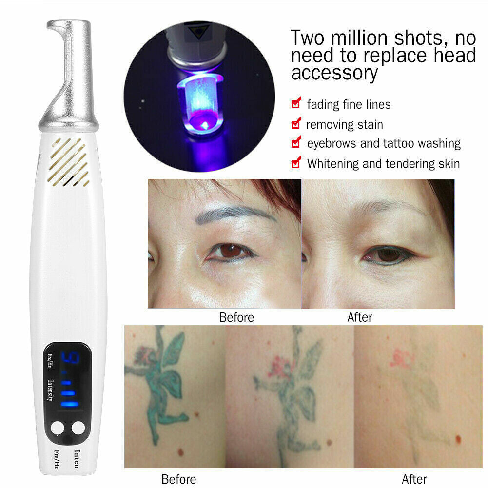 Handheld Red or Blue Pen Picosecond Spot Removal Pen Painless Eyebrow Washing Portable Tattoo Removal Skin Beauty for Home Use