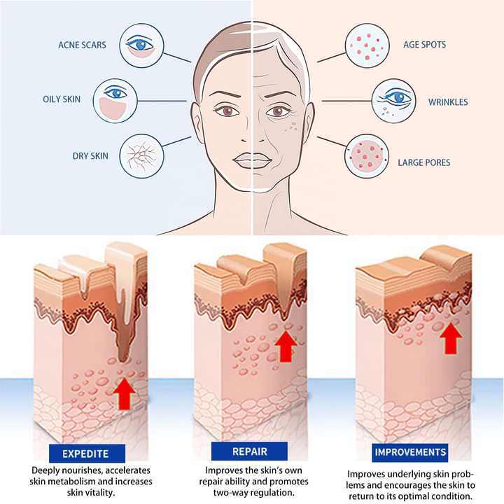DRS 40 Pin Derma Stamp Microneedling Tool 0.2-3.0mm Multi Needle Depth Collagen Boost Facial Skin Care Device