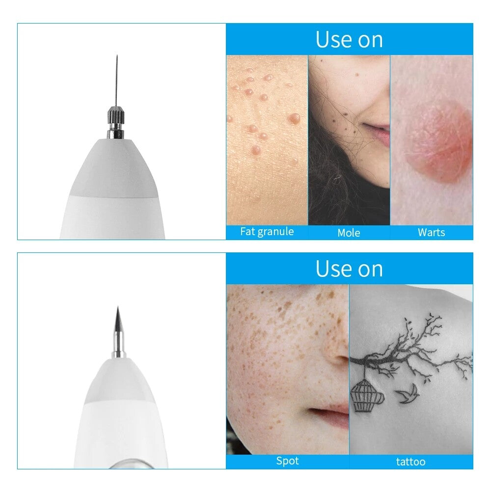 Dark Spot Freckle Laser Plasma Point Pen Needles Set For Mole Wart Tattoo Skin Tag Remover Face Care Replacement Accessories