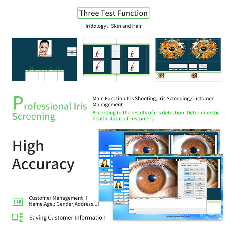 Portable Handheld Iris Scanner 12MP Digital Iriscope Analyzer Iridology Appliance Eye Camera Iris Scanner