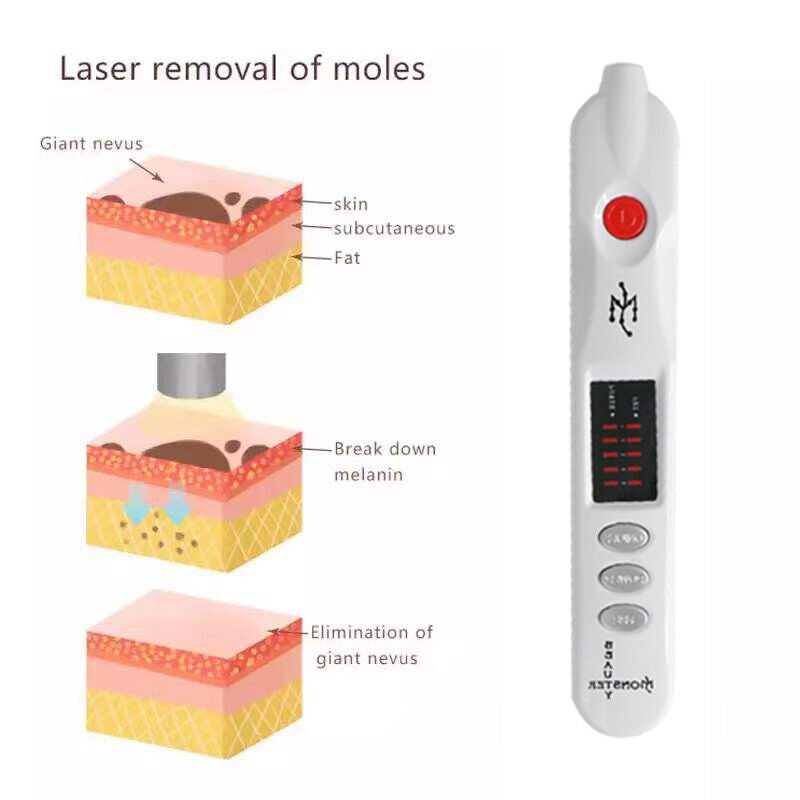 Professional Eyelid Lifting Beauty Monster Plasma Pen Handheld Beauty Pen LED Indicator for Skin Rejuvenation