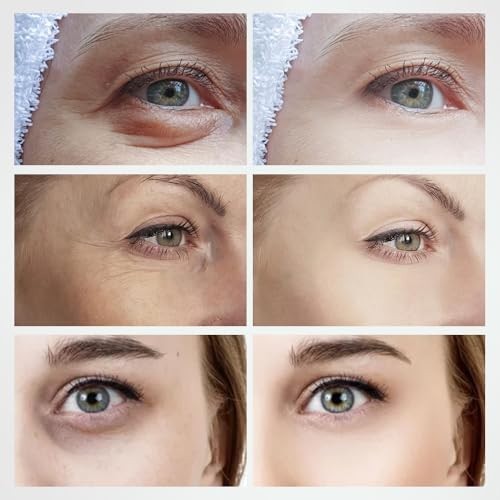 Eye Lifting Machine Face Lift Beauty Instrument Galvanic Micro Current Eye Bag Wrinkle Removal Device for Home Use Beauty Device
