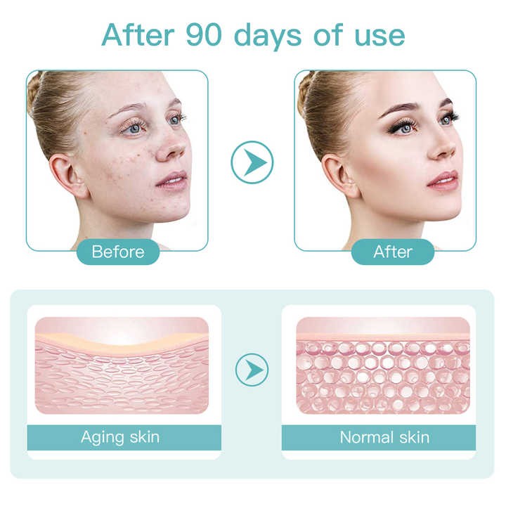 Mini Hifu Skin Care Machine LED Tightening Lifting  Anti-wrinkle Therapy Facial Beauty Device Home Use