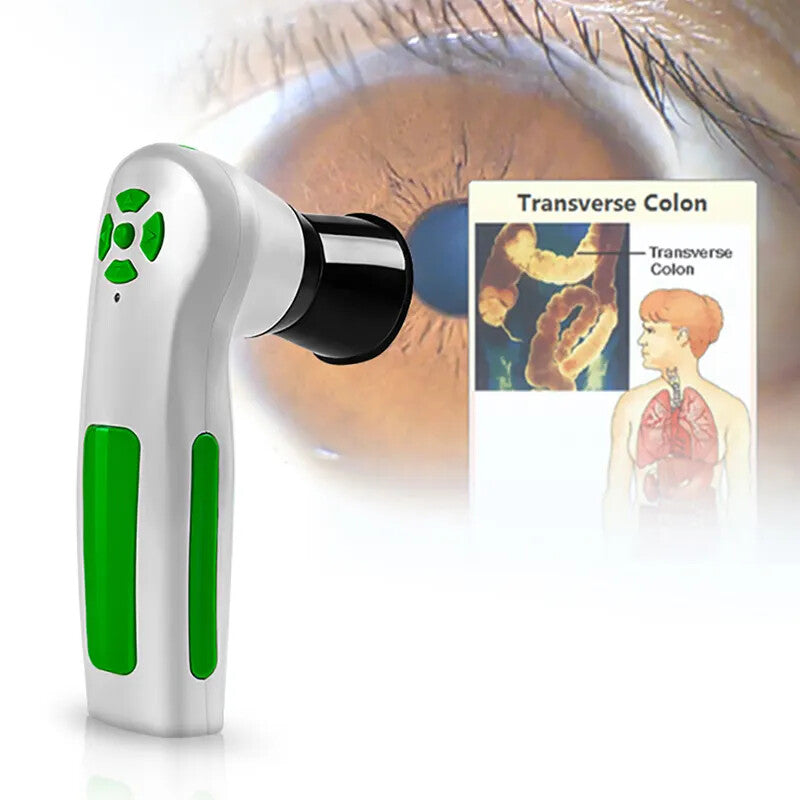 Portable Handheld Iris Scanner 12MP Digital Iriscope Analyzer Iridology Appliance Eye Camera Iris Scanner