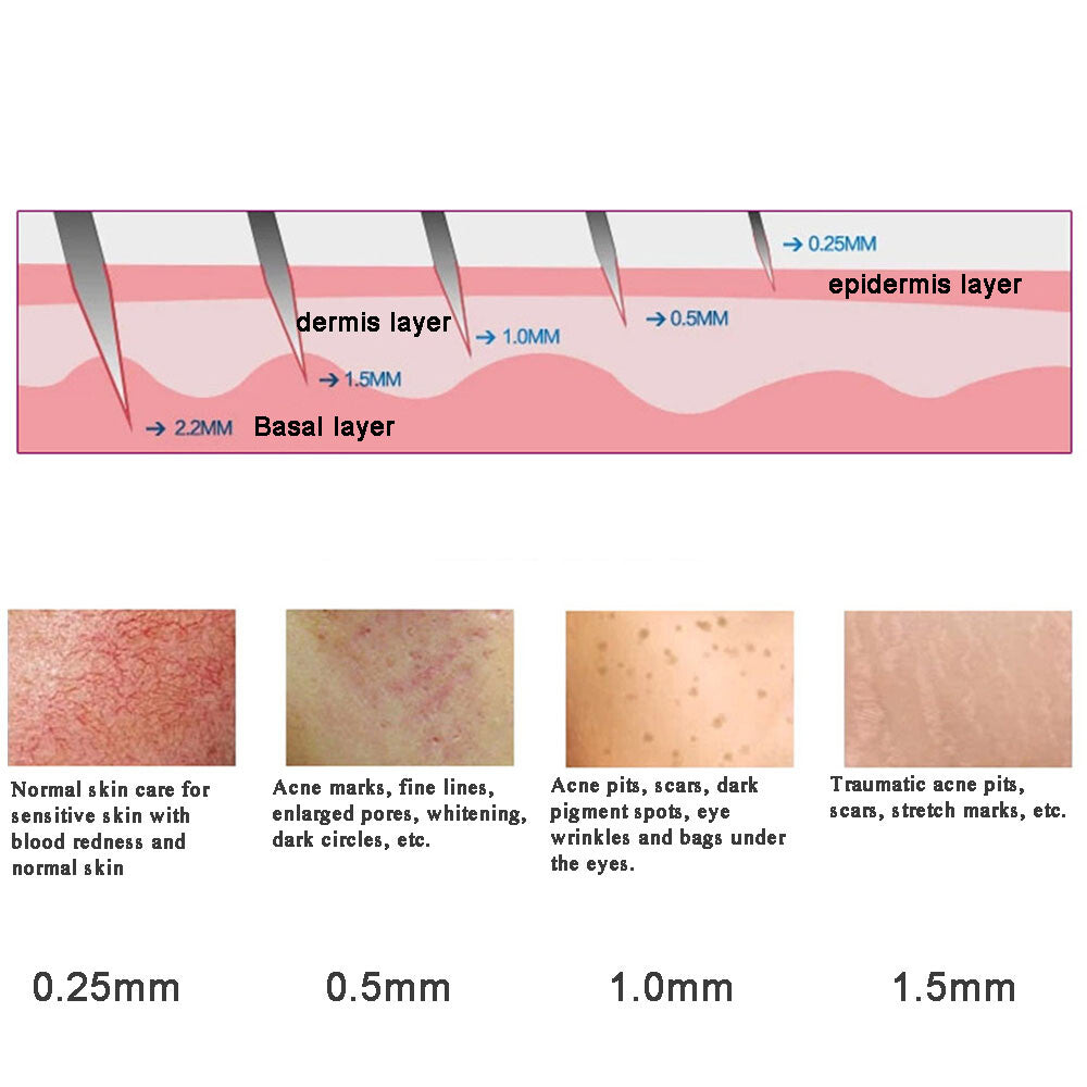 DRS 540 Titanium Microneedle Derma Roller Facial Skin Care Tool Boost Collagen Anti-Aging Reduce Wrinkles Pore Minimizing Device