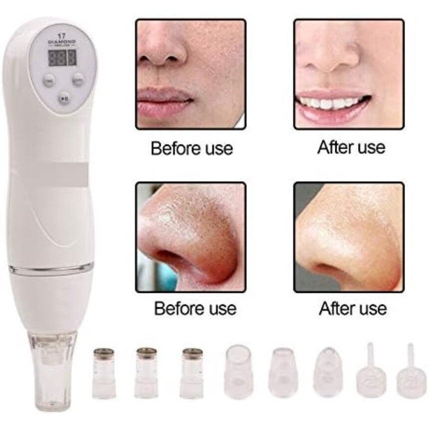Diamond Microdermabrasion Blackhead Removal Vacuum Peeling Skin Rejuvenation Dermabrasion Facial Massage Beauty Device