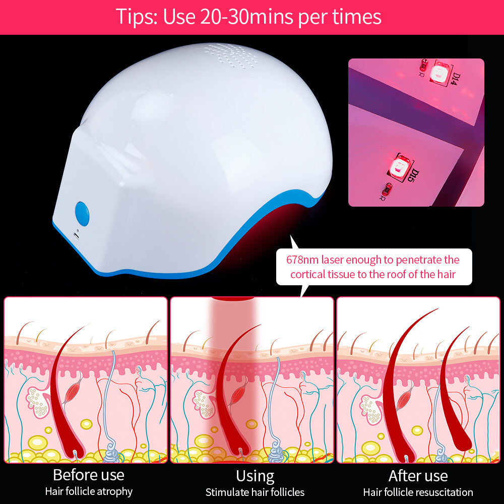 LED Red Light Hair Growth Helmet, Portable Scalp Phototherapy Cap for Thinning Hair, Home Hair Loss Regrowth Treatment Device