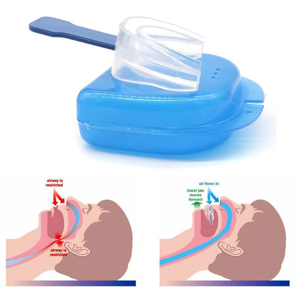 Anti Snore Mouthpiece Stop Snoring Aid Sleep Apnea Solution Comfortable Night Guard Dental Device Prevent Teeth Grinding Jaw Alignment Tongue Stabilizer Snore Stopper