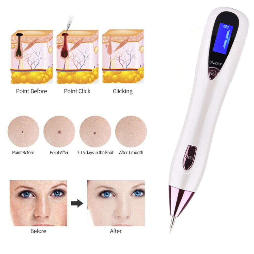 LCD Laser Skin Tag Freckle Wart Dot Mole Remove Pen Dark Spot Tattoo Removal USB Multi Function Beauty Equipment