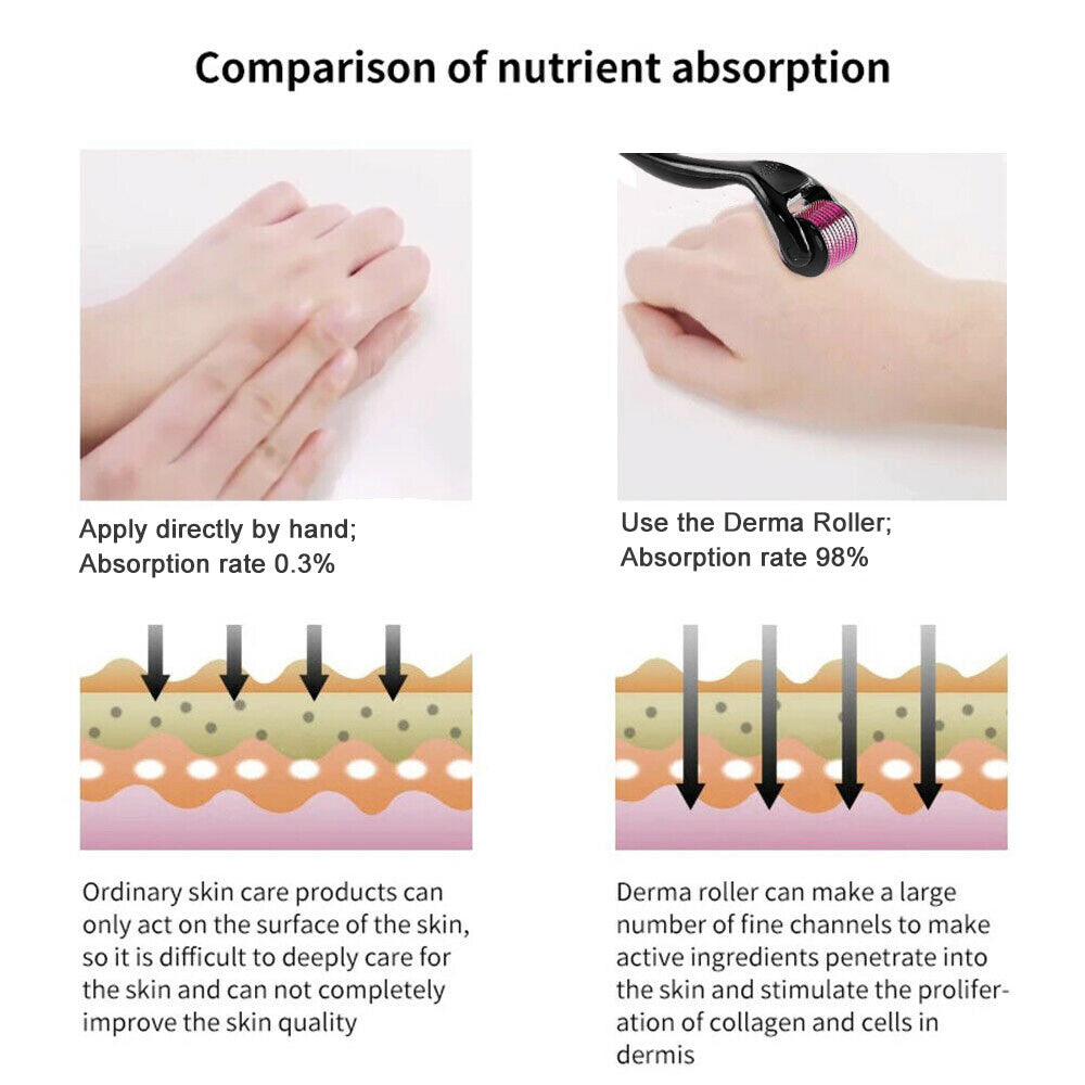 DRS 540 Titanium Microneedle Derma Roller Facial Skin Care Tool Boost Collagen Anti-Aging Reduce Wrinkles Pore Minimizing Device
