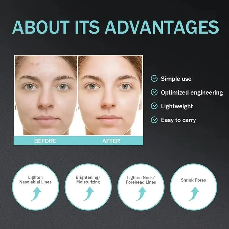 EMS Vibration LED Facial Skin Tightening Device Portable Anti Aging Face Massager Boost Skin Absorption Home Skincare Beauty Instrument
