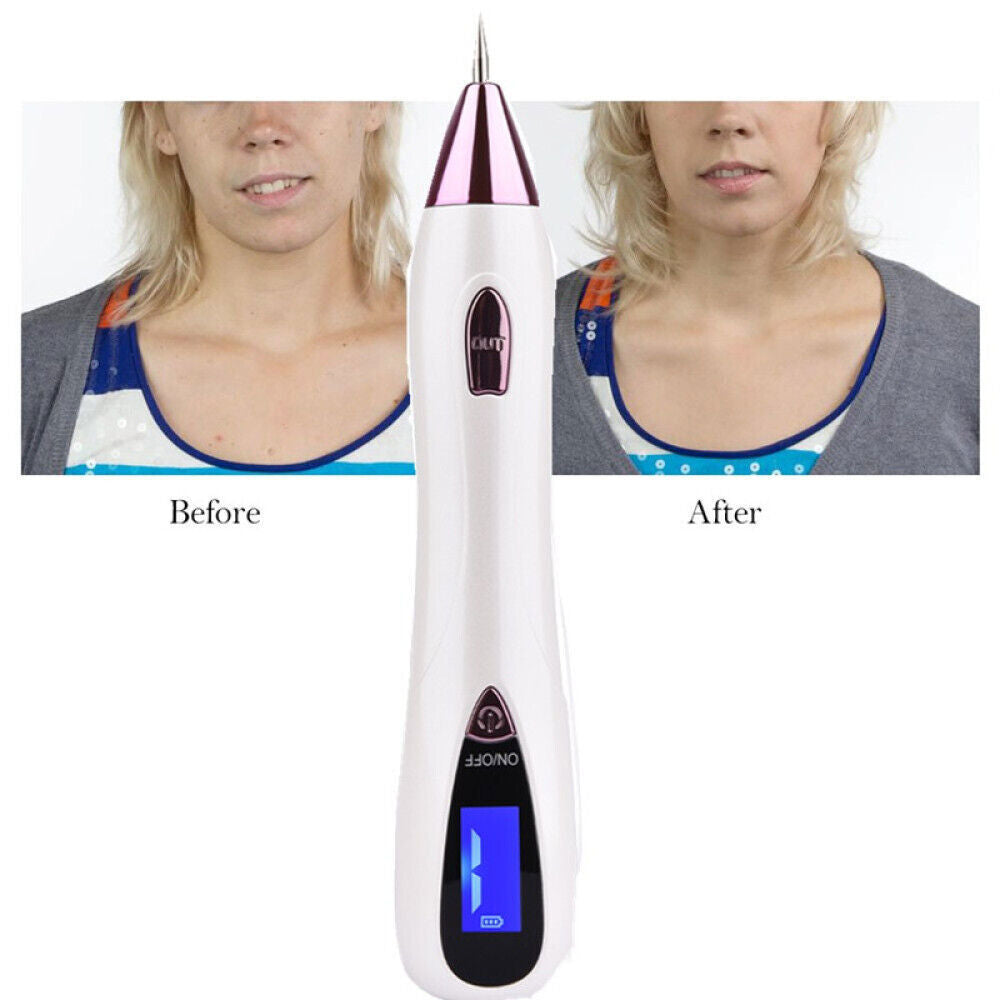 LCD Laser Skin Tag Freckle Wart Dot Mole Remove Pen Dark Spot Tattoo Removal USB Multi Function Beauty Equipment