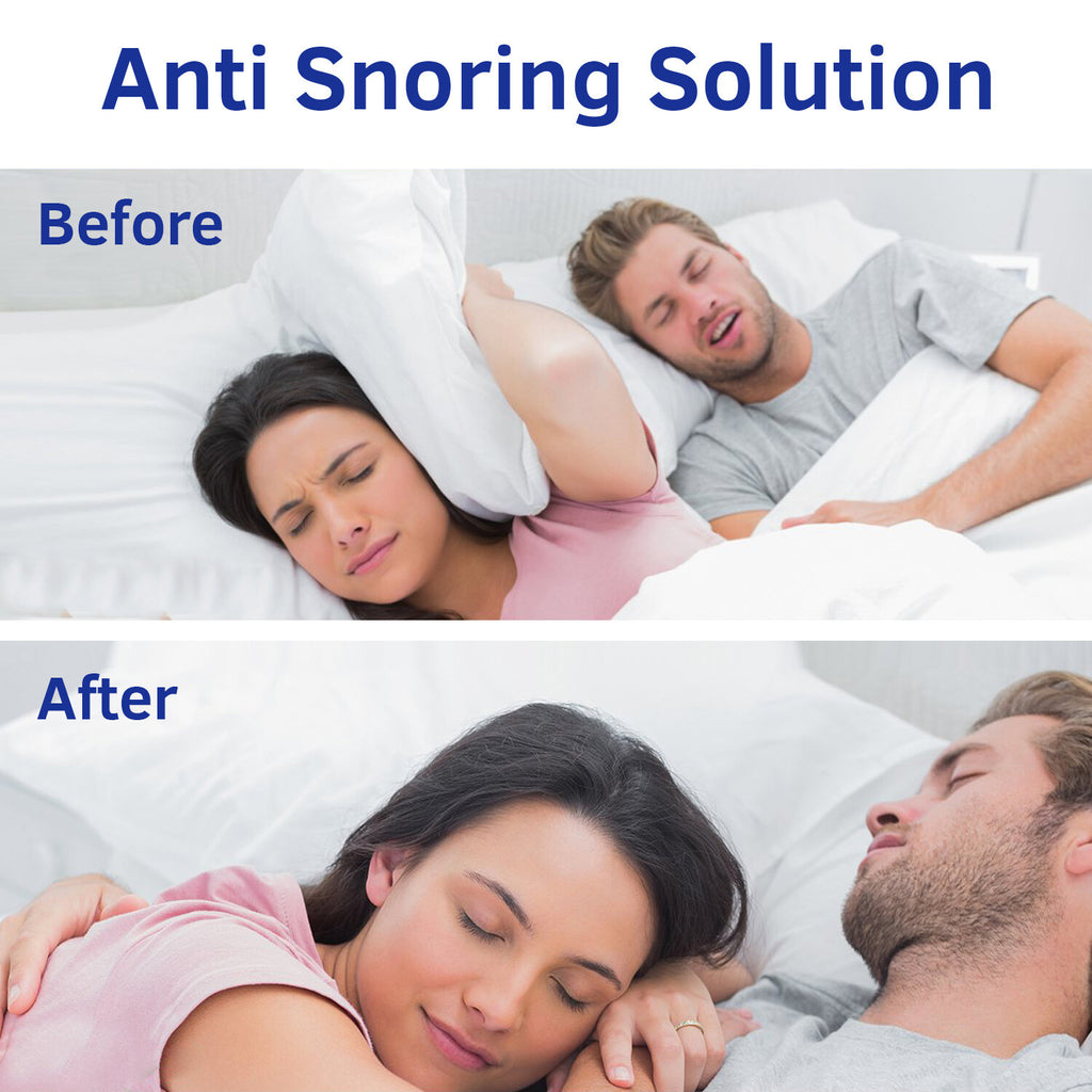 Anti Snore Mouthpiece Stop Snoring Aid Sleep Apnea Solution Comfortable Night Guard Dental Device Prevent Teeth Grinding Jaw Alignment Tongue Stabilizer Snore Stopper
