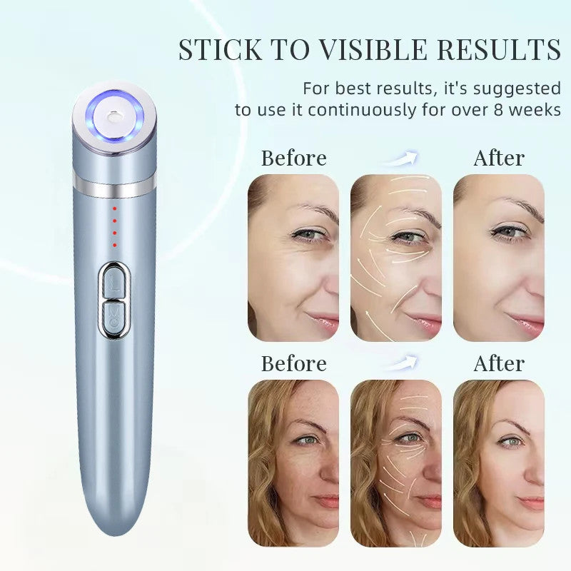 3 In 1 Electric Eye Massage Wand Rechargeable Heat Vibration Microcurrent Anti Wrinkle Dark Circle Eye Lifting Beauty Device