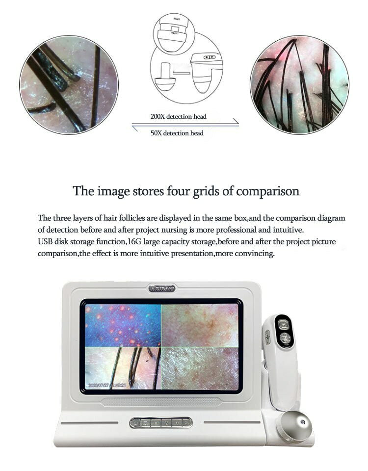 2 In 1 Skin Hair Scalp Analyzer Detector Machine 11 Inch LCD Screen Skin Hair Condition Tester for Beauty Salon Home Use