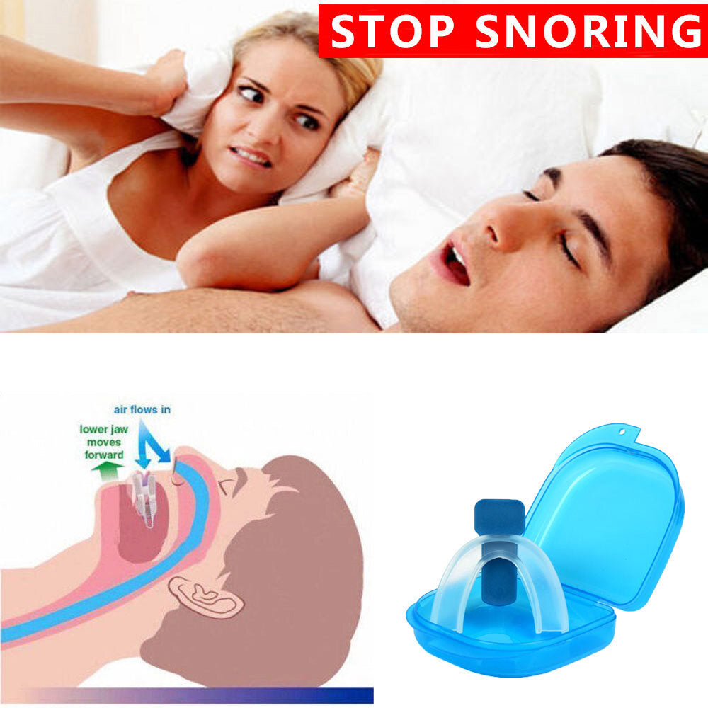 Anti Snore Mouthpiece Stop Snoring Aid Sleep Apnea Solution Comfortable Night Guard Dental Device Prevent Teeth Grinding Jaw Alignment Tongue Stabilizer Snore Stopper