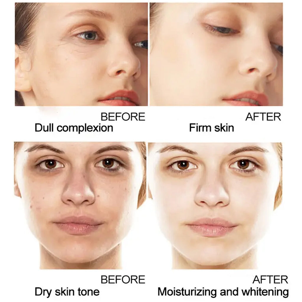 Mini Hifu Beauty Massager Face Lifting Skin Tightening Anti-aging Wrinkle Fat Removal Machine for Spa Salon and Home Use