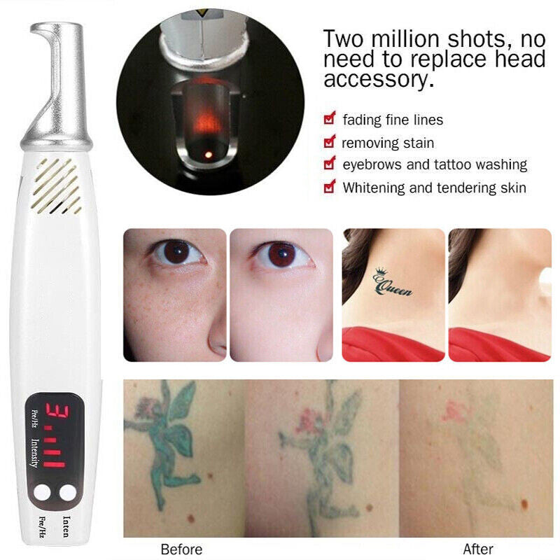 Handheld Red or Blue Pen Picosecond Spot Removal Pen Painless Eyebrow Washing Portable Tattoo Removal Skin Beauty for Home Use