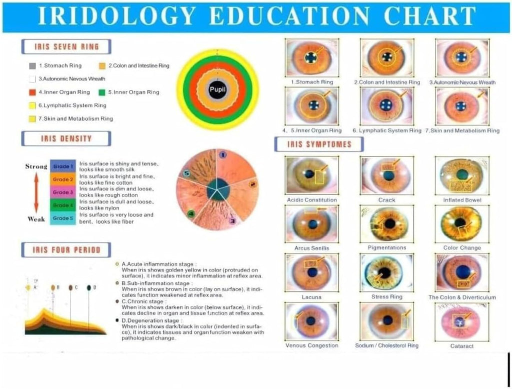 Iridology Camera,Iris Analyzer,USB Iriscope,High Resolution HD CCD USB Iriscope with Aluminum Box + Hd 13 Million Pixel + Iris Analysis Software
