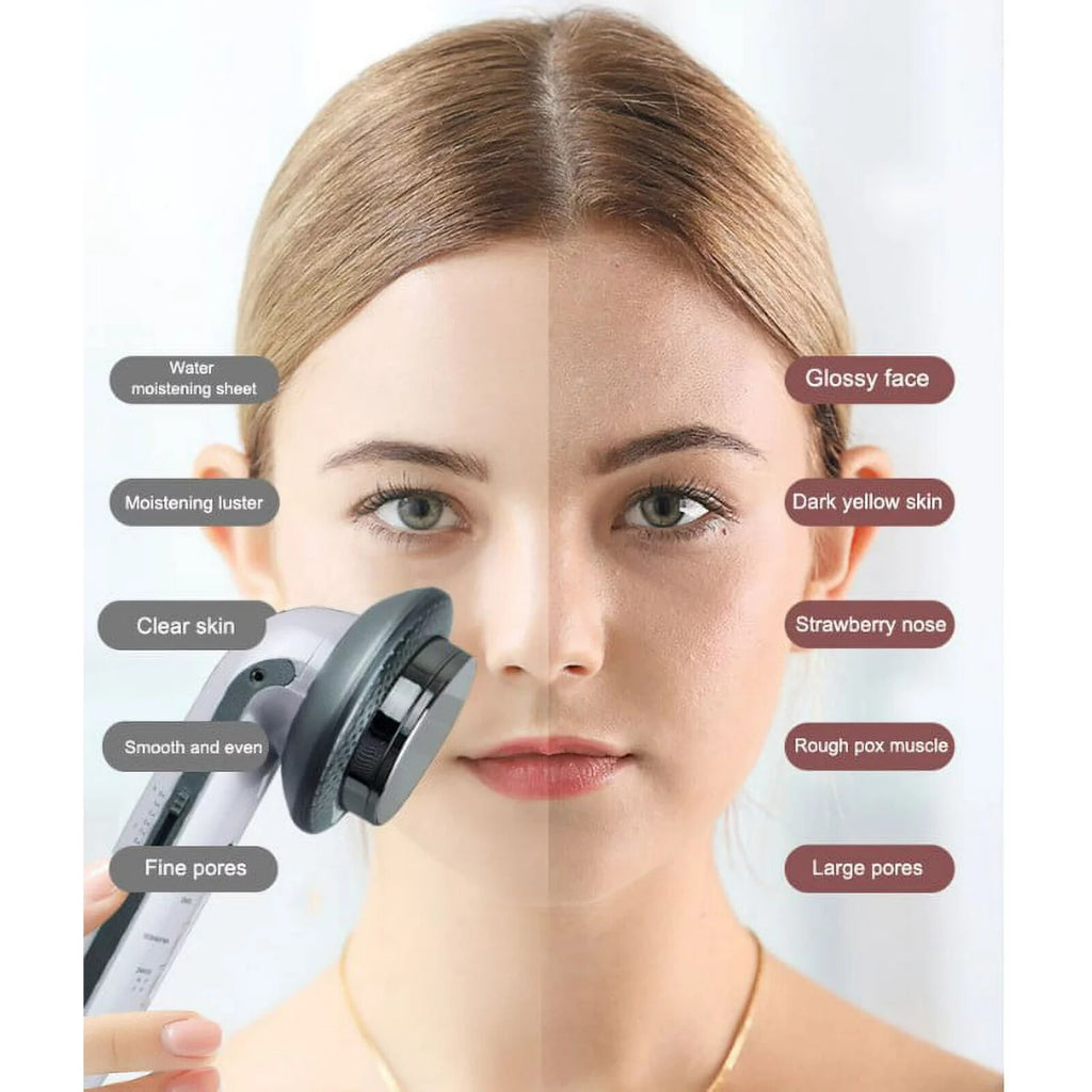 3 IN 1 Electric Microcurrent Slimming Beauty Instrument EMS Ultrasonic Massager Slimming and Fat Burning for Home Use