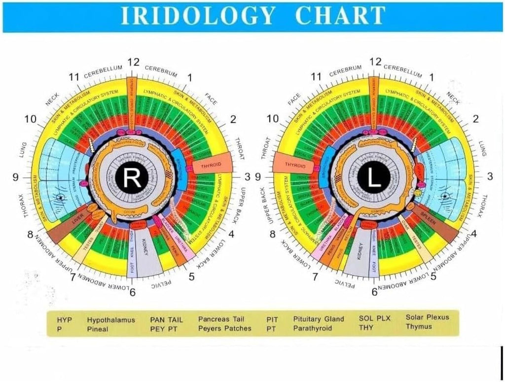 Iridology Camera,Iris Analyzer,USB Iriscope,High Resolution HD CCD USB Iriscope with Aluminum Box + Hd 13 Million Pixel + Iris Analysis Software