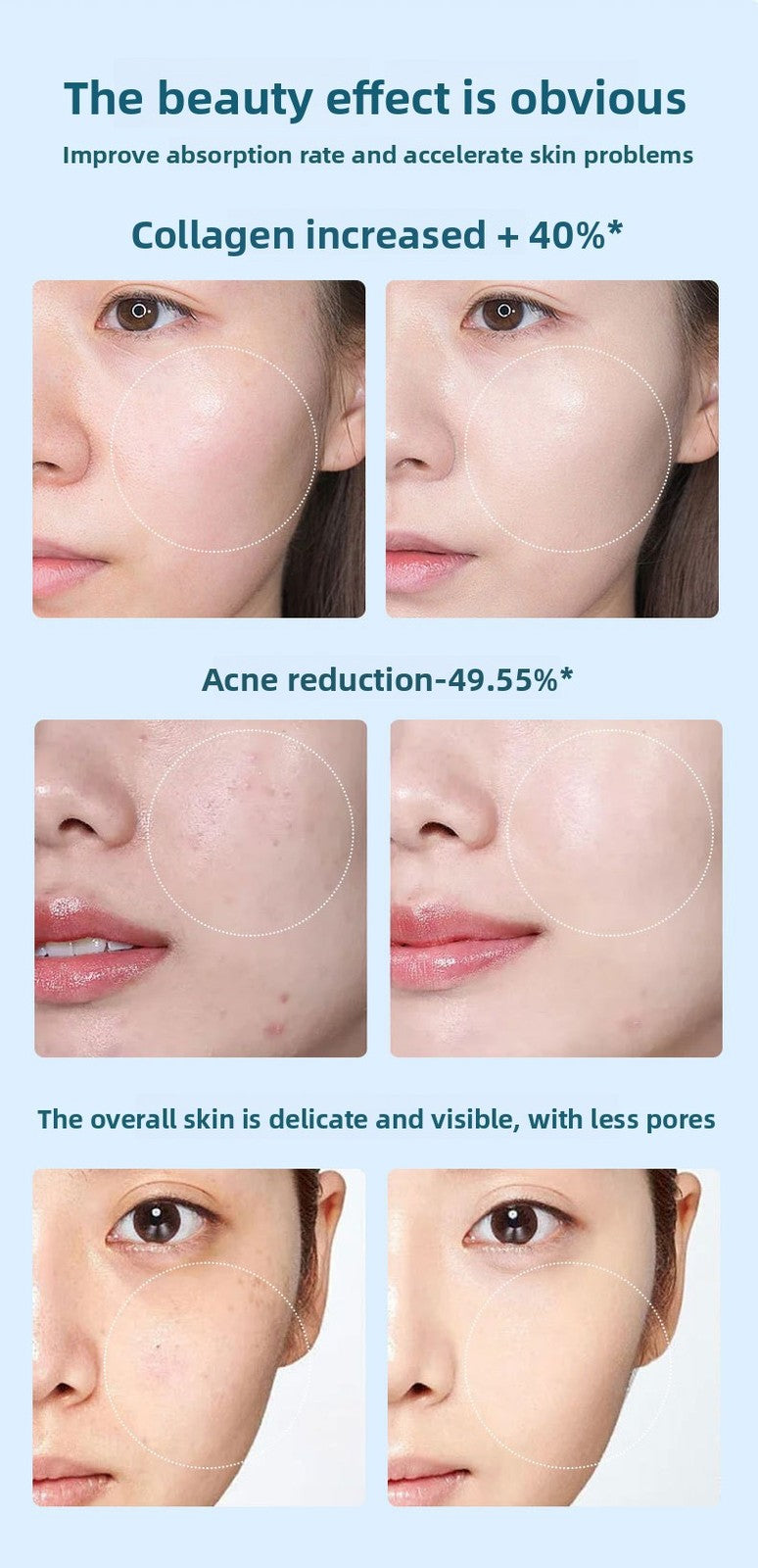 Auto Serum Feed Nano Microneedling Pen Electric Derma Pen Hydra Facial Skin Infusion Device for Home Salon Skin Beauty Treatment