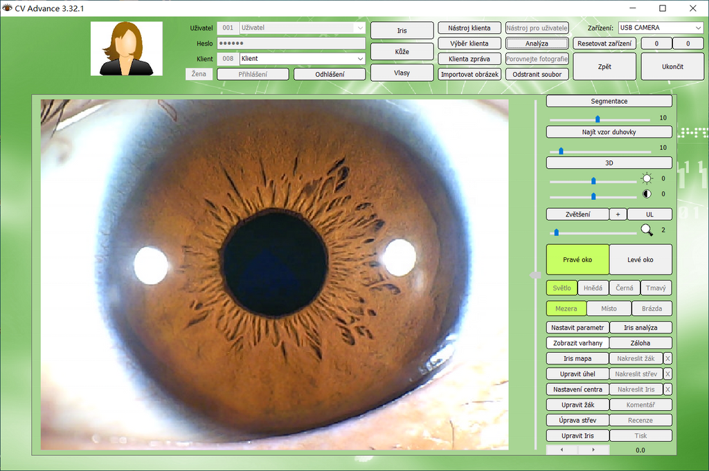 Iridology Camera Chart 5 MP HD 30X Iriscope 9809 Iris CCD Analysis V 3.31 Digital Iriscope Analyzer Iridology Appliance