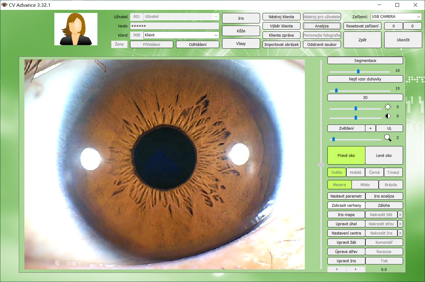 Iridology Camera Chart 5 MP HD 30X Iriscope 9809 Iris CCD Analysis V 3.31 Digital Iriscope Analyzer Iridology Appliance