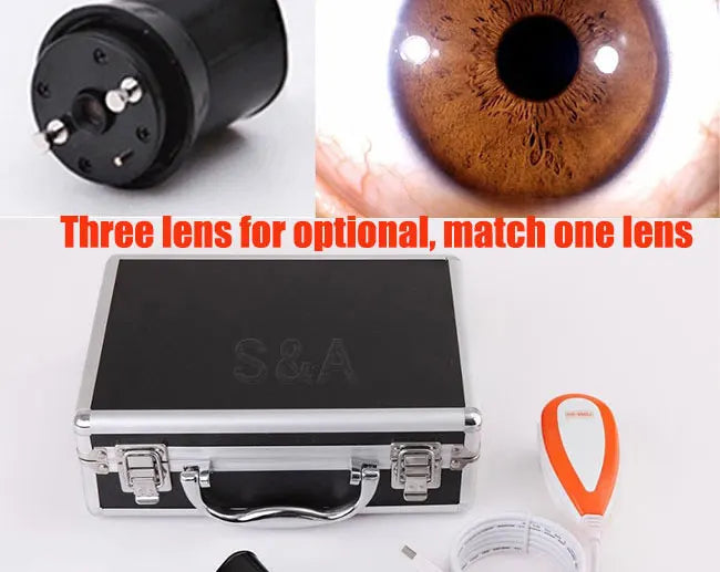 HD 5MP Computer Type USB Iris Detector Analyzer Magnifier Iridology Device Retinal Camera with Aluminum Alloy Box