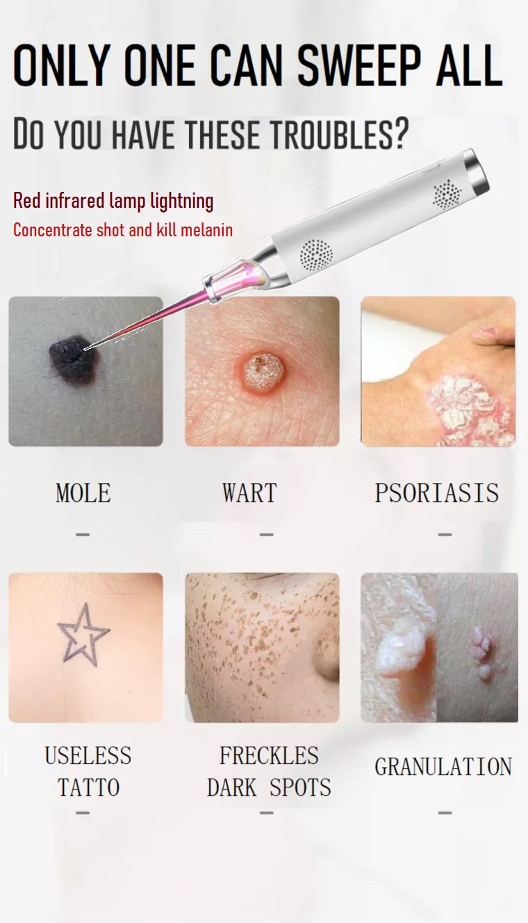 Portable Rechargeable Tattoo Removal Device Mole Removal 9 Modes Bule Light or Red Light Picosecond Mini Laser Pen