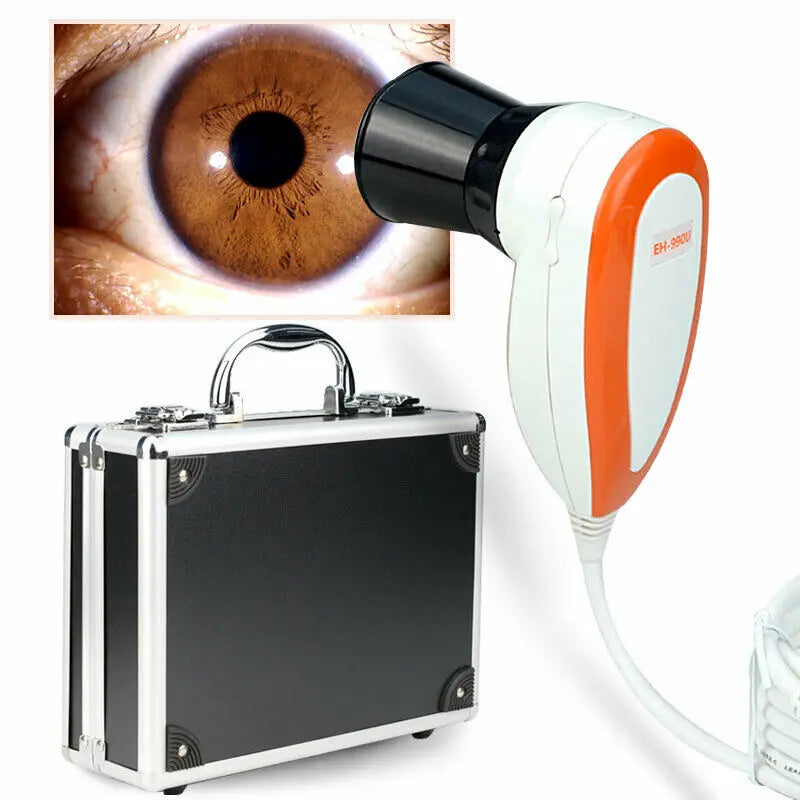 HD 5MP Computer Type USB Iris Detector Analyzer Magnifier Iridology Device Retinal Camera with Aluminum Alloy Box